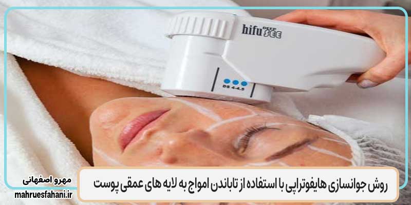 مقایسه هایفوتراپی (تابش امواج) و مزوژل (تزریق زیر پوست)