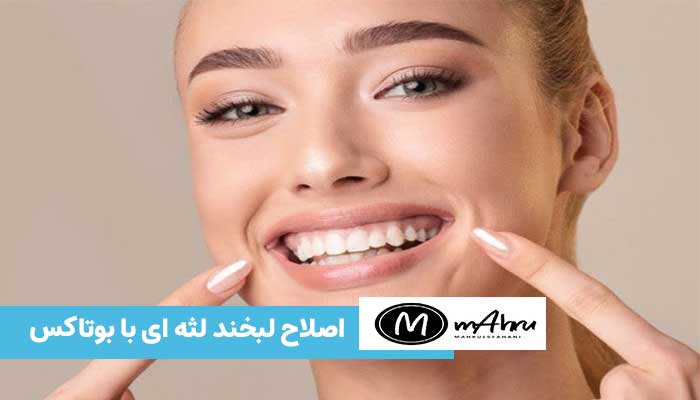 اصلاح و درمان لبخند لثه ای با تزریق بوتاکس