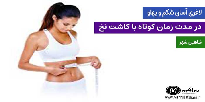 خدمات لاغری با کاشت نخ دکتر رویا تقی پور شاهین شهر اصفهان