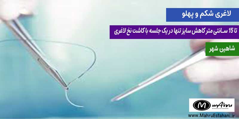 خدمات کاشت نخ لاغری دکتر رویا تقی پور شاهین شهر اصفهان