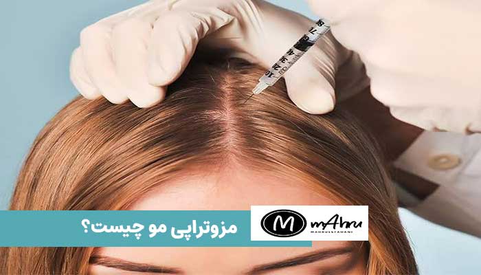 مزوتراپی برای مو