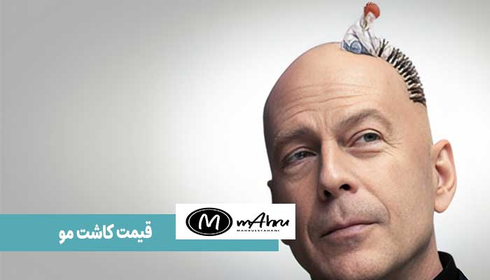 قیمت کاشت مو در اصفهان 1403