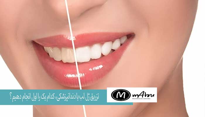دندانپزشکی یا تزریق ژل لب اول کدام را انجام دهیم؟