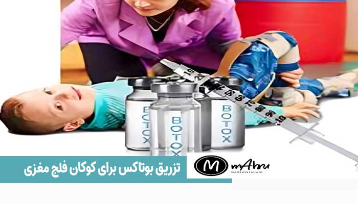 آمپول بوتاکس برای راه رفتن کودکان فلج مغزی