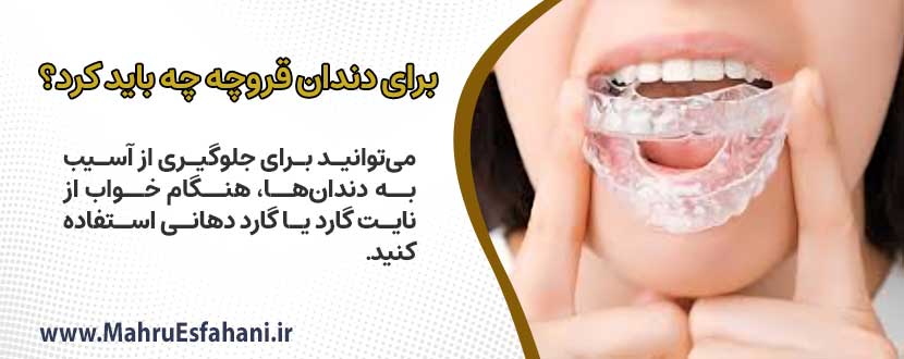 استفاده از نایت گارد یا گارد دهانی برای دندانقروچه