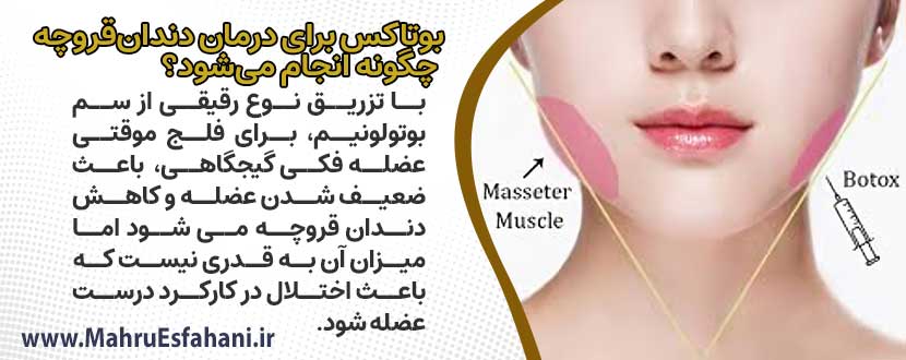 چگونه دندان قروچه درمان میشود؟