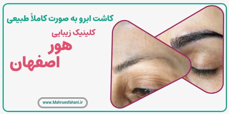 خدمات کاشت ابرو کاملاً طبیعی در کلینیک هور اصفهان