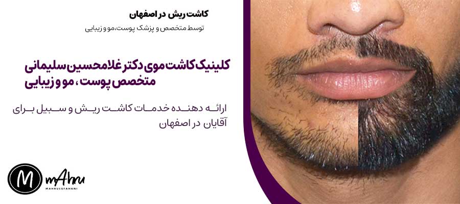 خدمات کاشت ریش و سبیل در اصفهان