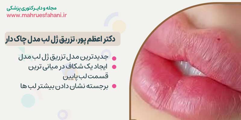 دکتر هایده اعظم پور متخصص تزریق ژل لب در اصفهان