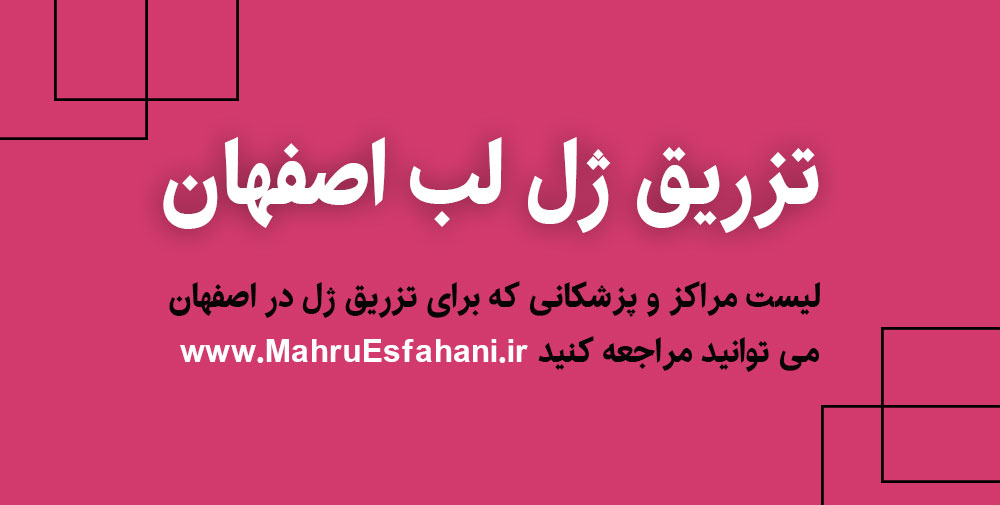 دکتر خوب برای تزریق ژل لب اصفهان