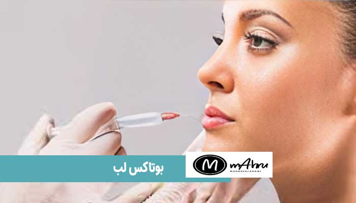 چرا بوتاکس لب بزنیم؟