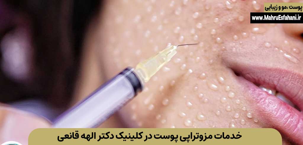 خدمات مزوتراپی پوست صورت در کلینیک دکتر الهه قانعی اصفهان