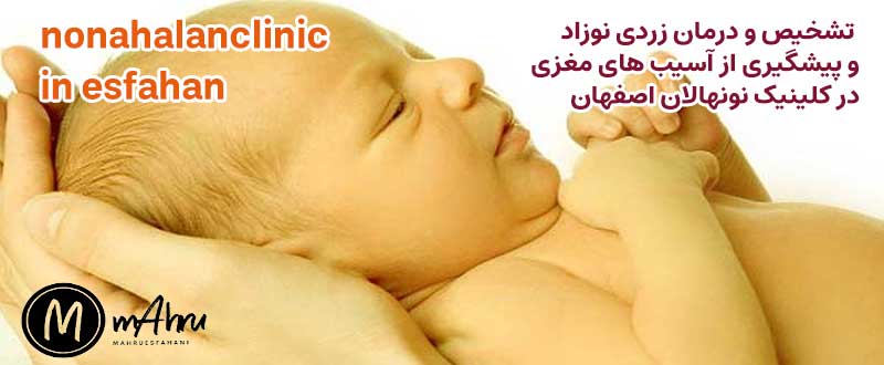 پیشگیری فلج مغزی ناشی از زردی نوزاد در کلینیک نونهالان اصفهان