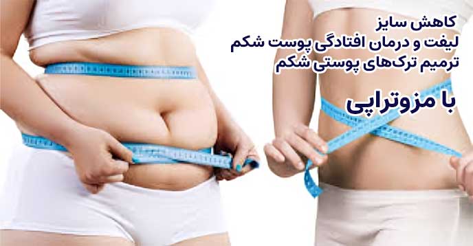 مزوتراپی برای لاغری را چگونه انجام بدیم؟
