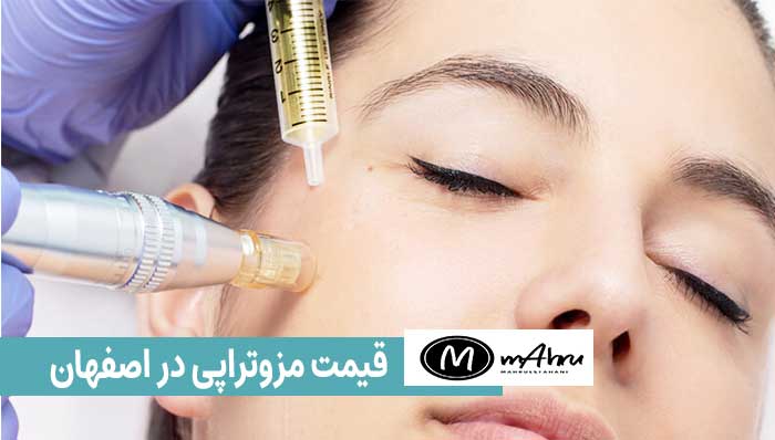 قیمت مزوتراپی مو چقدر است؟قیمت مزوتراپی زیر چشم،صورت،مو،ابرو و لاغری در اصفهان