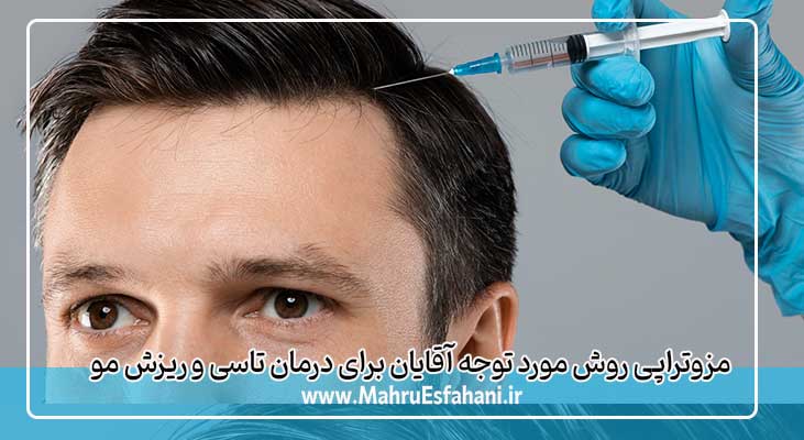 مزوتراپی مو و رفع کم پشتی