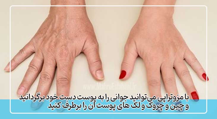 مزوتراپی دست ها و رفع پیری پوست دست