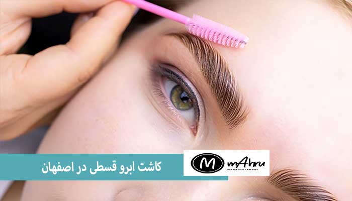 وام کاشت ابرو در اصفهان