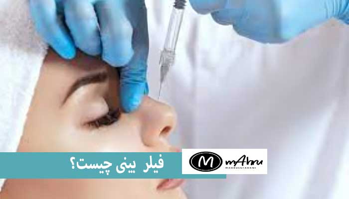 فیلر دماغ یا جراحی بینی با فیلر چیه؟