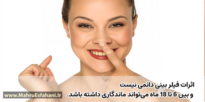 فیلر بینی چقدر چه مدت چند ماه چند سال دوام و ماندگاری دارد؟
