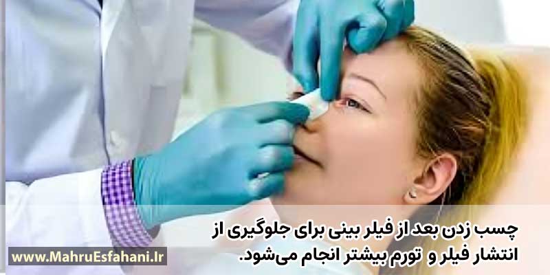 چند روز بعد از فیلر بینی میتوان به حمام رفت؟