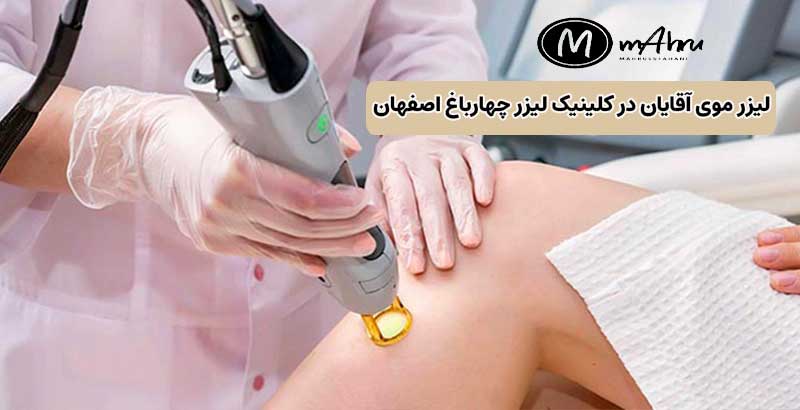 لیزر مو آقایان در اصفهان