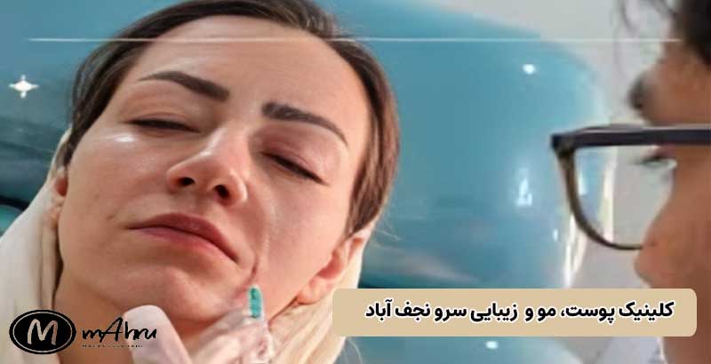 تزریق بوتاکس و ژل در بهترین کلینیک پوست نجفآباد با مدیریت دکتر علی حاتمی