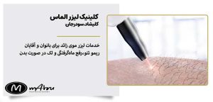 کلینیک الماس کلیشاد خدمات لیزر موی زائد نجف آباد اصفهان