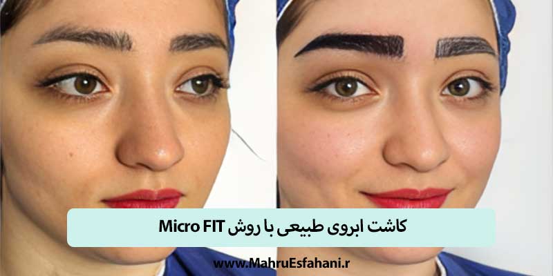 بهترین روش کاشت ابرو چیست؟