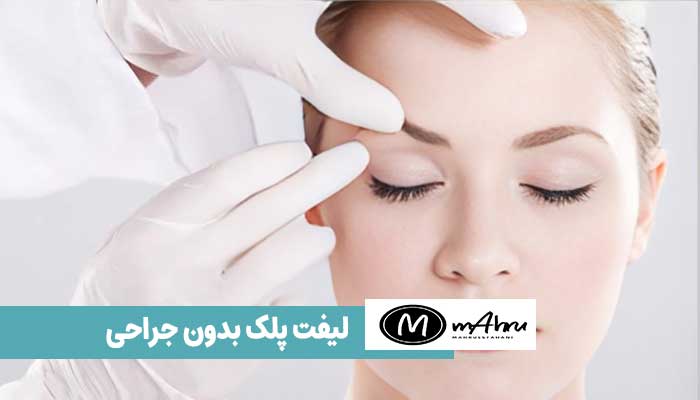 لیفت پلک بدون جراحی و برش