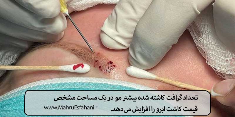 هزینه و قیمت کاشت ابرو سال 1403 چقدر است؟قیمت پک کاشت ابرو