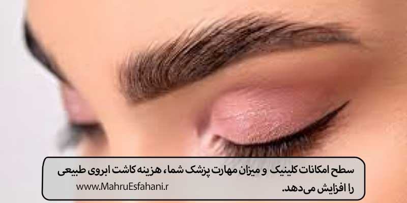 قیمت کاشت ابرو چند است؟قیمت کاشت ابرو در سال ۱۴۰۳و قیمت کاشت ابرو امروز