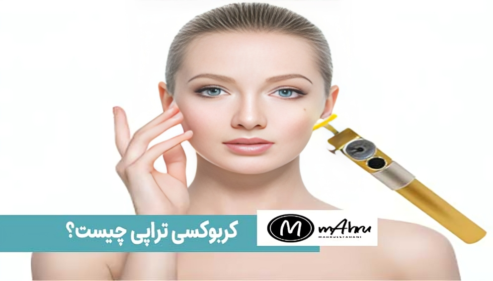 کربوکسی تراپی چیه و چه کار میکنه و چگونه انجام میشود؟