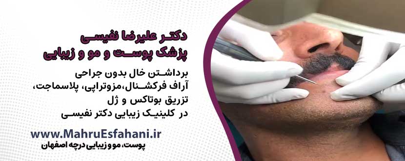 برداشتن خال و خدمات زیبایی در کلینیک دکتر علیرضا نفیسی در درچه اصفهان