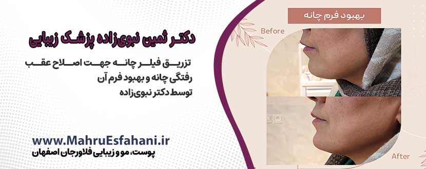 دکتر ثمین نبوی زاده دکتر پوست و مو فلاورجان اصفهان