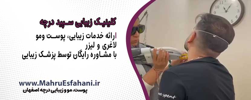لیزر موی زائد در درچه اصفهان