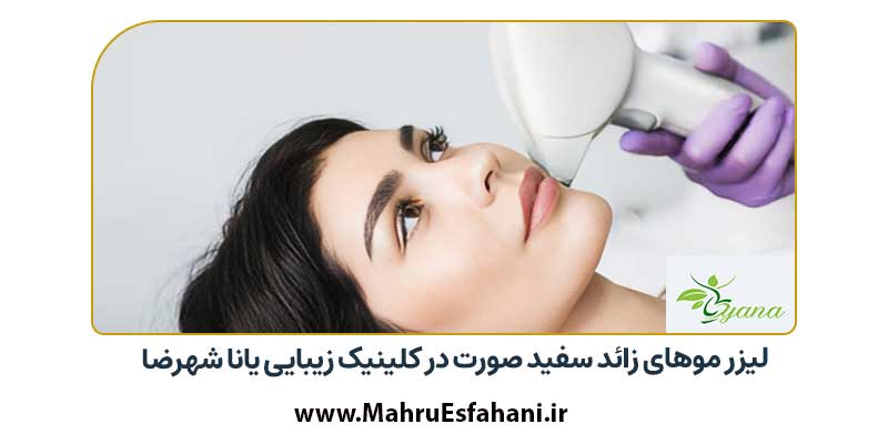 لیزر موی زائد در کلینیک زیبایی و لیزر یانا شهرضا