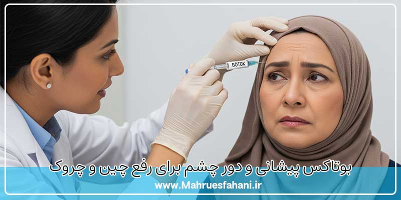 بوتاکس پیشانی و خط اخم ربرای رفع خطوط پیشانی