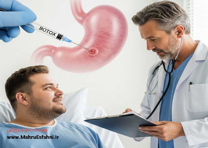 مراقبت های قبل و بعد از بوتاکس معده