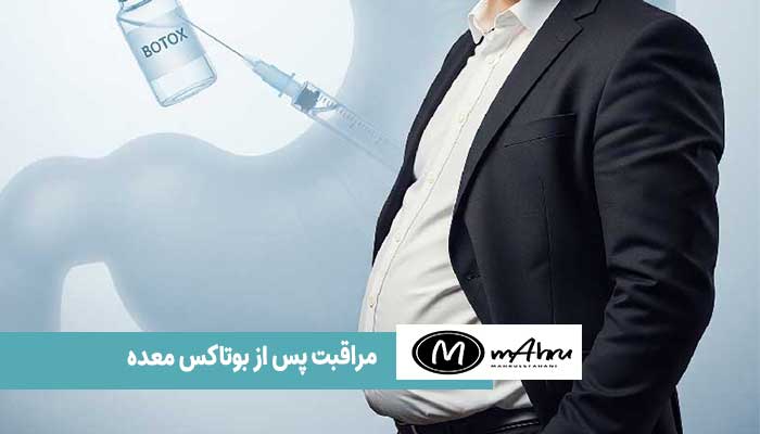 مراقبت های قبل و بعد از بوتاکس معده برای لاغری