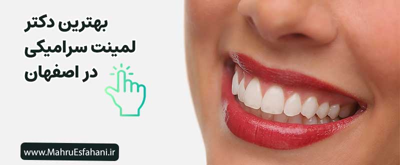 دکتر خوب لمینت سرامیکی در اصفهان