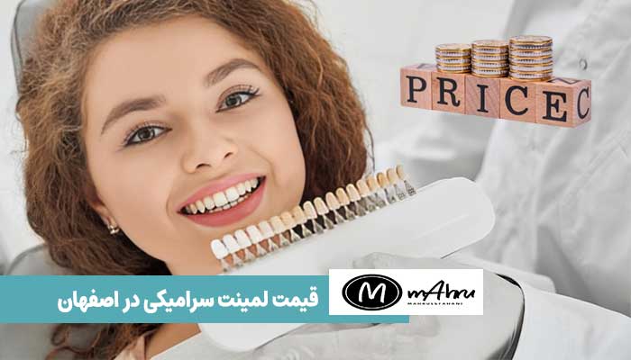 قیمت طرح لبخند و لمینت سرامیی در اصفهان چند است؟