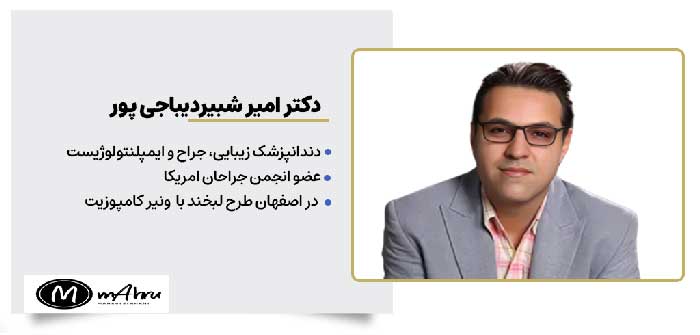 دکتر امیر شبیر دیباجی پور متخصص دندانپزشکی خدمات طرح لبخند با کامپوزیت در اصفهان