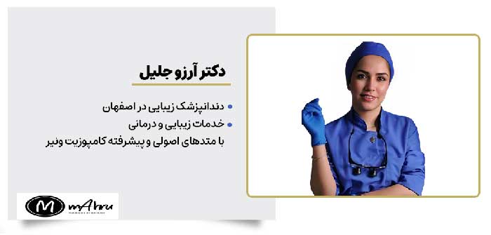 دگتر آرزو جلیل خدمات ترمیم و زیبایی دندان با کامپوزیت ونیر در اصفهان