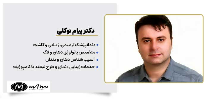 دکتر پیام توکلی متخصص دندانپزشکی خدمات ونیر کامپوزیت در اصفهان