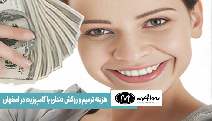 قیمت ونیر کامپوزیت در اصفهان چقدر و چگونه است؟
