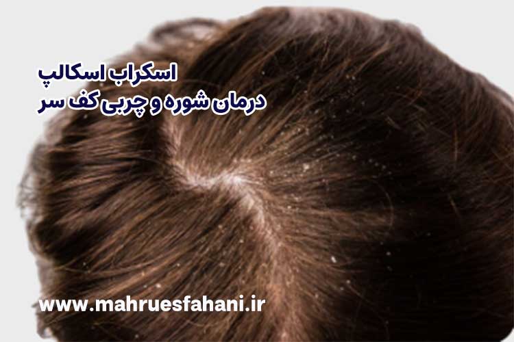 پاکسازی کف سر در آرایشگاه در اصفهان