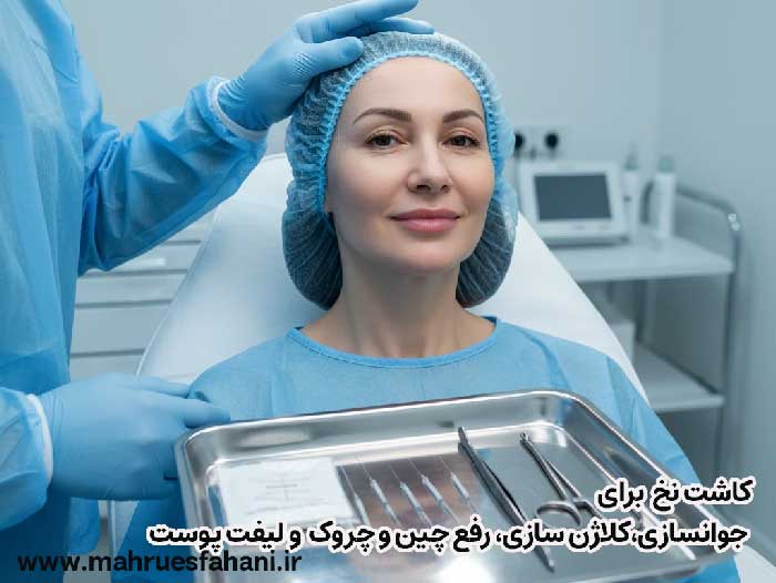 کاشت نخ برای صورت برای لفت پوست