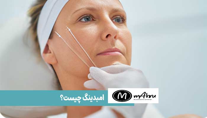 کاشت نخ یا امبدینگ