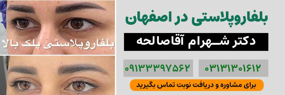 بهترین دکتر برای عمل پلک افتاده دکتر شهرام آقا صالحه در اصفهان